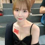 男人包皮过长环切是明智之举